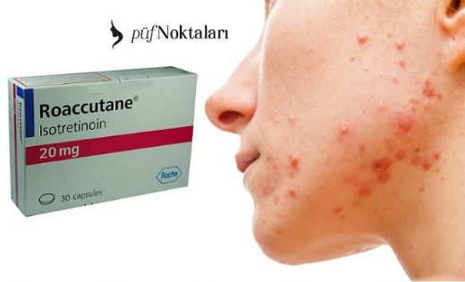 Roaccutane Nedir?