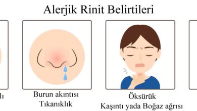 alerjik rinit nedir