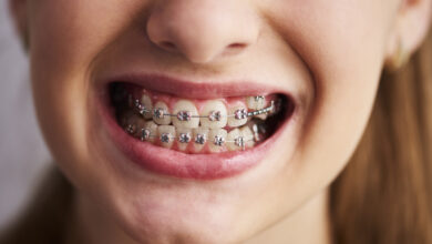 ortodontist nedir 1