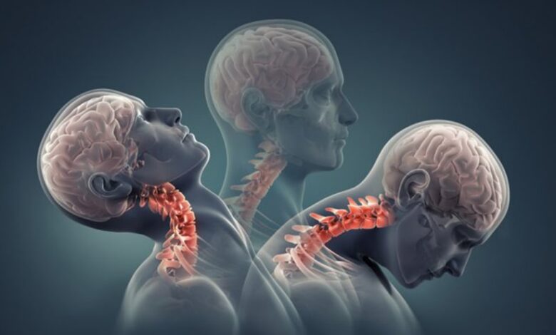 Boyun Fıtığı Nedir ? 1 boyun fitigi